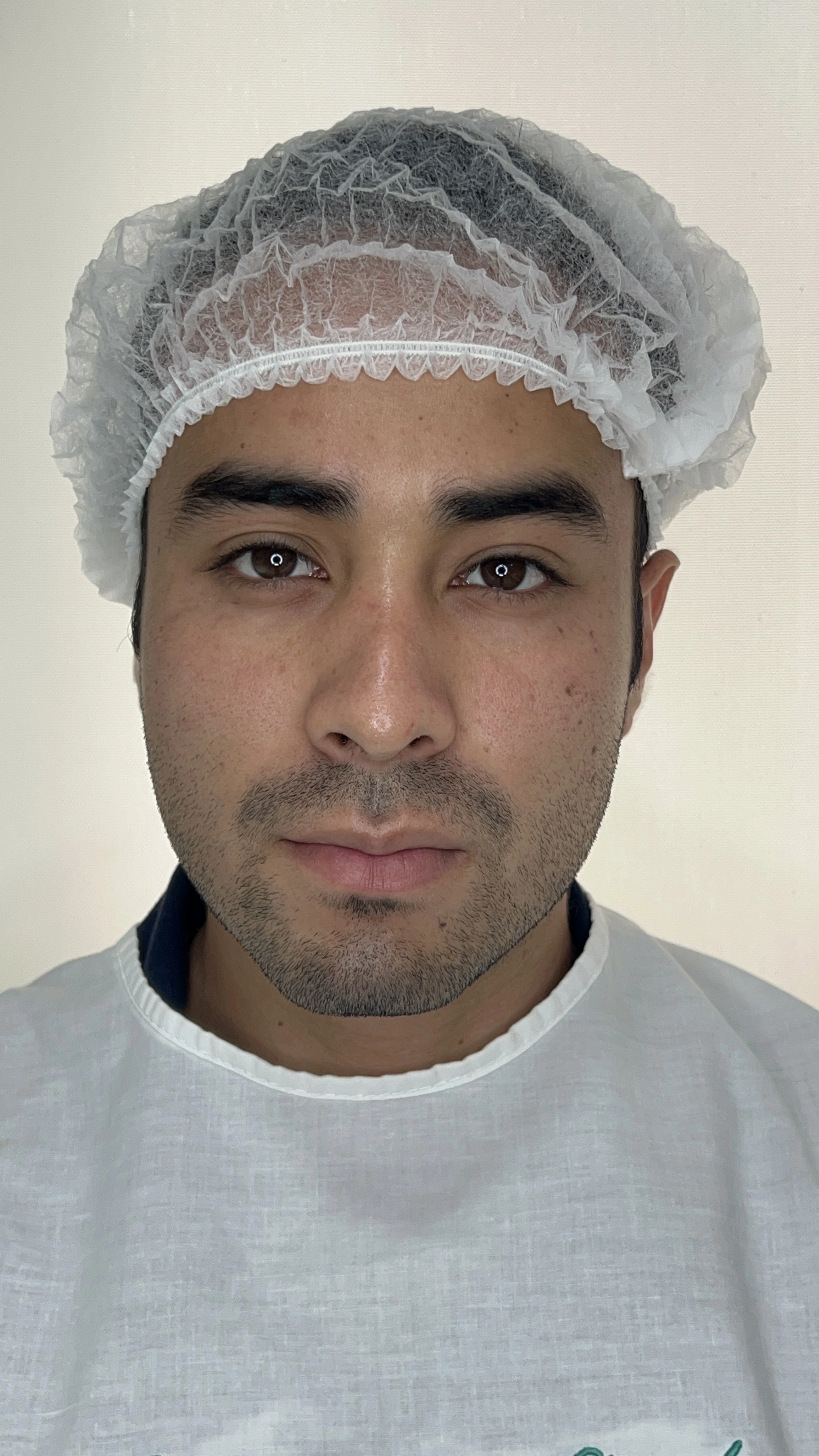 Antes de Perfilacion Mandíbular