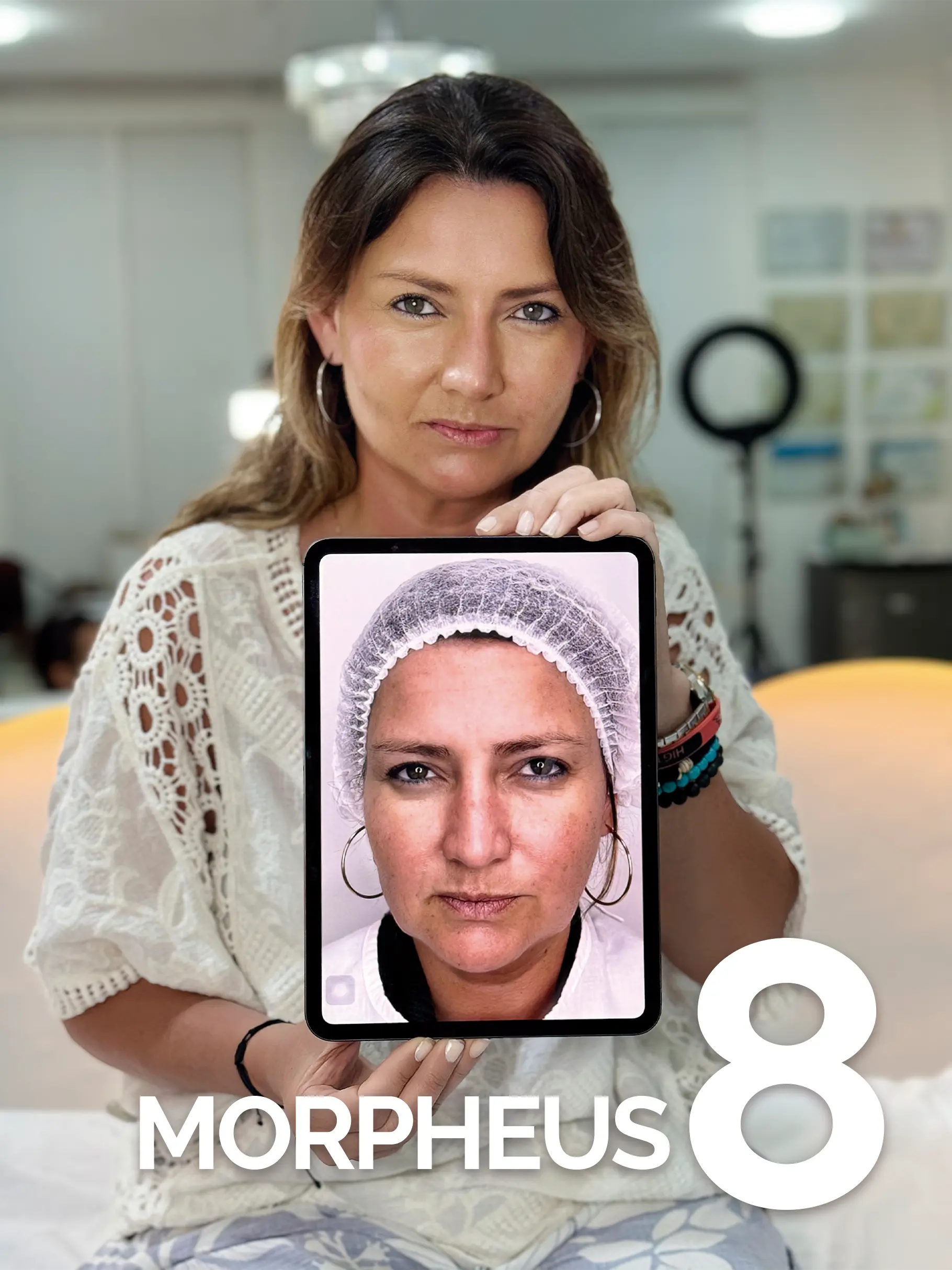 Tratamiento Morpheus8